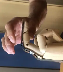 Prototyp der DPT-Orthese an einem Holzmodell mit Darstellung des Stützblocks