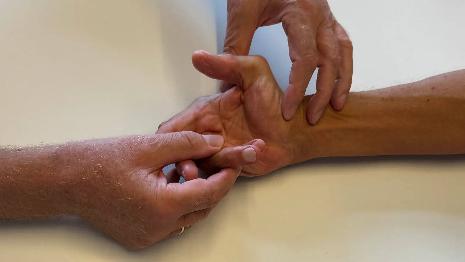 Untersuchung der Hand bei Morbus Dupuytren